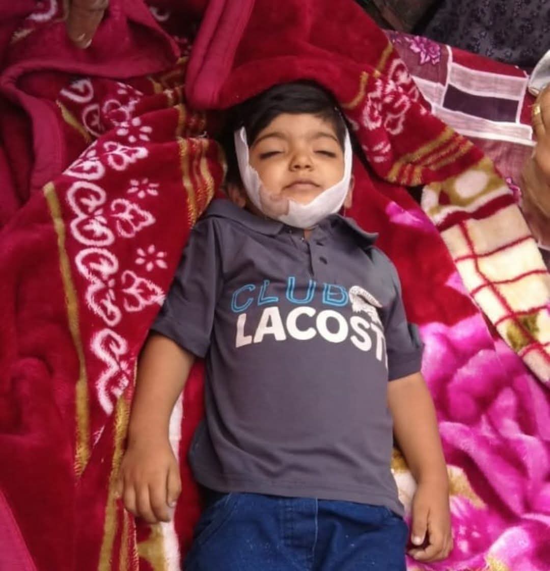 Tragic Death of 4-Year-Old in Poonch Sparks Allegations of Medical Negligence