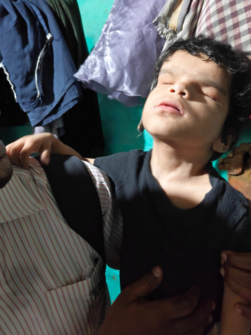Status of Services for People with Deafblindness and Multiple Disabilities in India