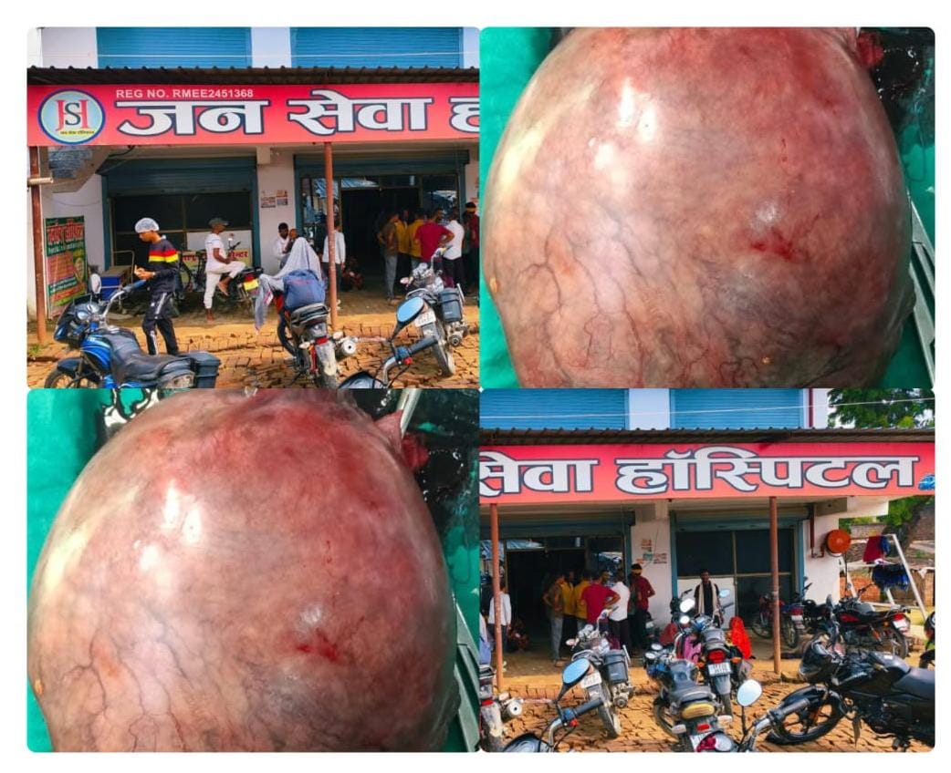 *कौशाम्बी के जन सेवा हॉस्पिटल का कमाल: बुजुर्ग महिला के पेट से निकाला 5 किलो का ट्यूमर, दी नई जिंदगी* *(आनन्द कुमार द्विवेदी, कौशाम्बी ब्यूरो)* *नारा, (कौशाम्बी)*